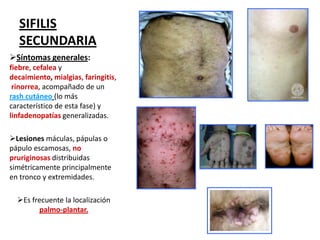 SIFILIS
SECUNDARIA
Síntomas generales:
fiebre, cefalea y
decaimiento, mialgias, faringitis,
rinorrea, acompañado de un
rash cutáneo (lo más
característico de esta fase) y
linfadenopatías generalizadas.
Lesiones máculas, pápulas o
pápulo escamosas, no
pruriginosas distribuidas
simétricamente principalmente
en tronco y extremidades.
Es frecuente la localización
palmo-plantar.

 