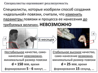 Специалисты, которые изобрели способ создания
«идеальной» повязки, считали, что изменить
параметры повязки и процесса ее нанесения до
требуемых величин, НЕВОЗМОЖНО
d 6 месяцев
Нестабильное качество, само-
нанесение невозможно,
минимальный размер повязки
d = 150 мм, время
формирования 5 - 6 минут, …
Стабильное высокое качество,
само-нанесение возможно,
минимальный размер повязки
d = 25 мм, время
формирования 15 секунд, …
d
Специалисты оценивают реализуемость
 