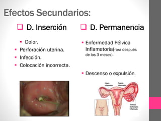 (2014-03-06) Anticoncepcion en AP (ppt) | PPTX