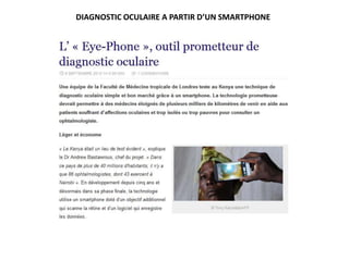 DIAGNOSTIC OCULAIRE A PARTIR D’UN SMARTPHONE
 