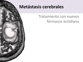 Metástasis cerebrales
Tratamiento con nuevos
fármacos antidiana
 