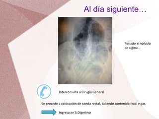Al día siguiente…
Persiste el vólvulo
de sigma…
Interconsulta a Cirugía General
Se procede a colocación de sonda rectal, saliendo contenido fecal y gas.
Ingresa en S.Digestivo
 