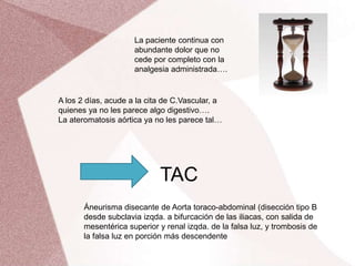 La paciente continua con
abundante dolor que no
cede por completo con la
analgesia administrada….
TAC
Áneurisma disecante de Aorta toraco-abdominal (disección tipo B
desde subclavia izqda. a bifurcación de las iliacas, con salida de
mesentérica superior y renal izqda. de la falsa luz, y trombosis de
la falsa luz en porción más descendente
A los 2 días, acude a la cita de C.Vascular, a
quienes ya no les parece algo digestivo….
La ateromatosis aórtica ya no les parece tal…
 