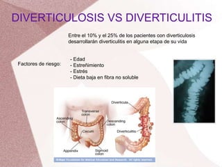 DIVERTICULOSIS VS DIVERTICULITIS
Factores de riesgo:
- Edad
- Estreñimiento
- Estrés
- Dieta baja en fibra no soluble
Entre el 10% y el 25% de los pacientes con diverticulosis
desarrollarán diverticulitis en alguna etapa de su vida
 
