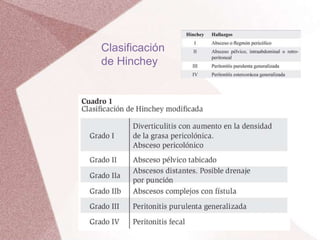 Clasificación
de Hinchey
 