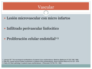 Vascular
 Lesión microvascular con micro infartos
 Infiltrado perivascular linfocitico
 Proliferación celular endotelial1-3
1. Johnson RT: The neurological manifestations of systemic lupus erythematosus. Medicine (Baltimore) 47:337–369, 1968.
2. Ellis SG: Central nervous system involvement in systemic lupus erythematosus. Semin Arthritis Rheum 8:212–221, 1979.
3. Hanly JG: Brain pathology in systemic lupus erythematosus. J Rheumatol 19:732–741, 1992.
 