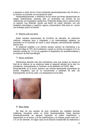 y aparecen a partir de los 3 años remitiendo aproximadamente a los 30 años, y 
su número no aumenta con la exposición solar. 
Histopatológicamente, a diferencia de los nevus que tienen agrupaciones de 
células melanocíticas, presenta sólo un incremento del número de los 
melanocitos con hiperplasia epidérmica. El llamado léntigo senil o actínico tiene 
un aspecto muy diferente, siendo una lesión de mayor diámetro, con una 
tonalidad marronácea y superfcie rugosa y descamativa. Sólo tiene en común 
con el léntigo juvenil el nombre. 
12 
6) Mancha café con leche 
Estas máculas amarronadas de 0,5-20cm de diámetro, de coloración 
uniforme, márgenes lisos e irregulares y sin sintomatología subjetiva, se 
presentan en el momento de nacer o poco después, permaneciendo estables 
toda la vida. 
Si aparecen aisladas y en número escaso carecen de importancia y su 
frecuencia llega al 10% de la población, cuando su número es superior a 6 y su 
diámetro excede los 1,5 cm es sugestivo el diagnóstico de neurofibromatosis y 
el síndrome de McCune-Albright. 
7) Nevus de Becker 
Deberíamos llamarla más bien hamartoma, pero que aunque se insinúa al 
final de la infancia no se evidencia hasta la segunda década de la vida. Su 
prevalencia, principalmente en hombres, es de alrededor de 0,50%. Más 
frecuentemente en el tronco aparece una mancha ligeramente pigmentada de 
bordes irregulares, que se va oscureciendo y poblando de pelo. Se 
hiperpigmenta con la luz solar y no desaparece con la edad. 
8) Nevo Spilus 
Se trata de una variante de nevo constituido por múltiples lesiones 
melánicas maculares sobre un fondo hiperpigmentado. Estas lesiones 
característicamente se agrupan siguiendo un patrón zosteriforme o 
segmentario en el tronco o en las extremidades y el conjunto puede medir de 1 
a 4 cm de diámetro. En algún caso se ha descrito el desarrollo de melanoma o 
 