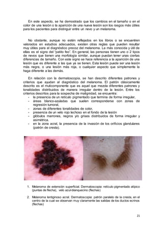 En este aspecto, se ha demostrado que los cambios en el tamaño o en el 
color de una lesión o la aparición de una nueva lesión son los rasgos más útiles 
para los pacientes para distinguir entre un nevo y un melanoma. 
No obstante, aunque no estén reflejados en los libros o se encuentren 
valorados en estudios adecuados, existen otras reglas que pueden resultar 
muy útiles para el diagnóstico precoz del melanoma. La más conocida y útil de 
ellas es el signo del “patito feo”. En general, las personas tienen uno o 2 tipos 
de nevos que tienen una morfología similar, aunque puedan tener unas ciertas 
diferencias de tamaño. Con este signo se hace referencia a la aparición de una 
lesión que es diferente a las que ya se tienen. Esta lesión puede ser una lesión 
más negra, o una lesión más roja, o cualquier aspecto que simplemente la 
haga diferente a las demás. 
En relación con la dermatoscopia, se han descrito diferentes patrones y 
criterios que ayudan al diagnóstico del melanoma. El patrón clásicamente 
descrito es el muticomponente que es aquel que mezcla diferentes patrones y 
tonalidades distribuidos de manera irregular dentro de la lesión. Entre los 
criterios descritos para la sospecha de malignidad, se encuentra: 
- la presencia de un retículo pigmentado que termina de forma irregular, 
- áreas blanco-azuladas que suelen corresponderse con zonas de 
21 
regresión tumoral, 
- zonas de diferentes tonalidades de color, 
- presencia de un velo rojo lechoso en el fondo de la lesión 
- glóbulos marrones, negros y/o grises distribuidos de forma irregular y 
asimétrica. 
- en la zona acral, la presencia de la invasión de los orificios glandulares 
(patrón de cresta). 
1. Melanoma de extensión superficial. Dermatoscopia: retículo pigmentado atípico 
(puntas de flecha), velo azul-blanquecino (flechas) 
2. Melanoma lentiginoso acral. Dermatoscopia: patrón paralelo de la cresta, en el 
centro de la cual se observan muy claramente las salidas de los ductos ecrinos 
(flechas) 
 