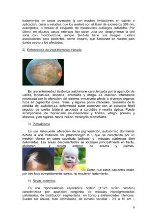 tratamientos en casos puntuales (y con muchas limitaciones en cuanto a 
aplicación, coste y estudios que los avalen) son el láser de excímeros 308 nm, 
autoinjertos, o incluso el trasplante de melanocitos autólogos cultivados. Por 
último, en algunos casos extensos hay quien opta por despigmentar la piel 
sana con monobenzona, aunque también tiene sus riesgos. Existen 
asociaciones para pacientes, como Aspavit, que funcionan en nuestro país 
dando apoyo a los afectados. 
6 
2) Enfermedad de Vogt-Koyanagi-Harada 
Es una enfermedad sistémica autoinmune caracterizada por la aparición de 
uveítis, hipoacusia, alopecia, encefalitis y vitíligo. La reacción inflamatoria 
provocada por la alteración del sistema inmunitario afecta a diversos órganos 
ricos en pigmentos (úvea, retina, y algunos pares craneales, causantes de la 
pérdida de audición).La enfermedad suele comenzar con un episodio febril 
seguido de uveitis bilateral asociada a coroiditis y neuritis óptica. Puede 
acompañarse de hipoacusia neurosensorial y tinnitus, vitíligo, poliosis y 
alopecia, y en algunos casos incluso meningitis o encefalitis. 
3) Piebaldismo 
Es una infrecuente alteración de la pigmentación, autosómico dominante 
debido a una mutación del protooncogén KIT, que se caracteriza por un 
mechón blanco en cuero cabelludo (poliosis) y máculas acrómicas bien 
delimitadas. Las áreas despimentadas se localizan principalmente en frente, 
abdomen y región anterior de brazos y piernas. 
Como que estos pacientes están, 
por otro lado completamente sanos, no requieren tratamiento. 
4) Nevus acrómico 
Es una hipomelanosis esporádica común (1:125 recién nacidos) 
caracterizada por aparición congénita de máculas hipopigmentadas 
unilaterales, de distribución segmentaria en tronco y extremidades inferiores. 
Suelen ser únicas, bien delimitadas, de tamaño variable - 0’5 a 10 cm -, 
 