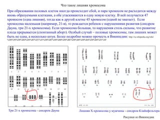 Что такое лишняя хромосома
При образовании половых клеток иногда происходит сбой, и пара хромосом не расходится между
вновь образуемыми клетками, а обе утаскиваются в одну новую клетку. В ней получается 47
хромосом (одна лишняя), тогда как в другой клетке 45 хромосом (одной не хватает). Если
хромосома маленькая (например, 21-я), то рождается ребенок с нарушениями развития (синдром
Дауна, три 21-х хромосомы). Если хромосома большая, то нарушения столь сильны, что развитие
плода прерывается (спонтанный аборт). Особый случай – половые хромосомы, там лишних может
быть не одна, а несколько штук. Более подробно можно прочесть в Википедии: http://ru.wikipedia.org/wiki/
%D0%90%D0%BD%D0%B5%D1%83%D0%BF%D0%BB%D0%BE%D0%B8%D0%B4%D0%B8%D1%8F
Лишняя Х-хромосома у мужчины - синдром КлайнфельтераТри 21-х хромосомы - синдром Дауна
Рисунки из Википедии
 