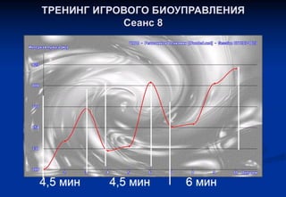ТРЕНИНГ ОПТИМАЛЬНОГО ФУНКЦИОНИРОВАНИЯ (ИГРОВОЕ БИОУПРАВЛЕНИЕ) Групповой и индивидуальный варианты