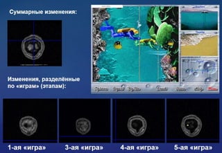 ТРЕНИНГ ОПТИМАЛЬНОГО ФУНКЦИОНИРОВАНИЯ (ИГРОВОЕ БИОУПРАВЛЕНИЕ) Групповой и индивидуальный варианты