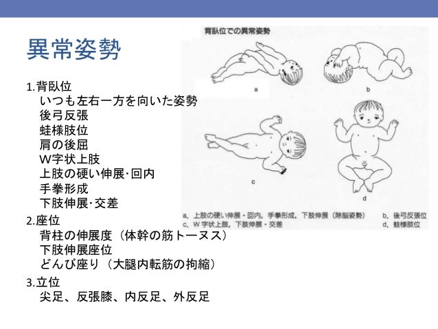 日本助産師会研修会14 新生児 乳児の診方 日本助産師会研修会14 新生児 乳児の診方