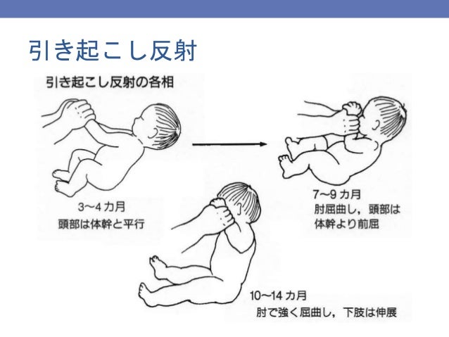 日本助産師会研修会14 新生児 乳児の診方