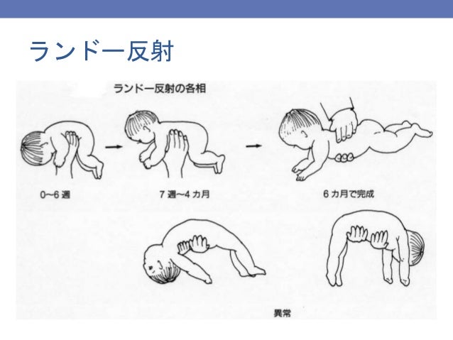 日本助産師会研修会14 新生児 乳児の診方