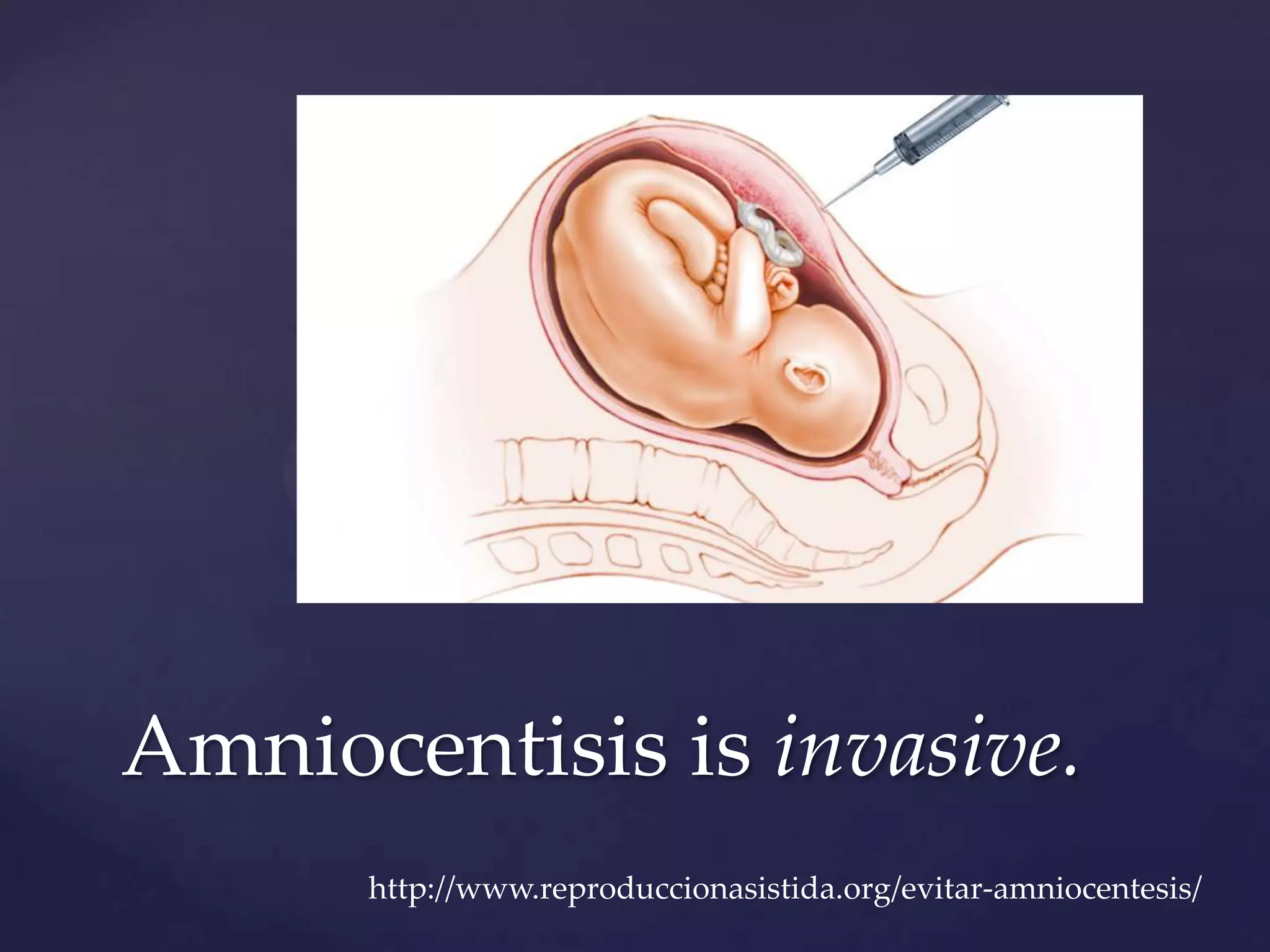 Amniocentisis is invasive.
http://www.reproduccionasistida.org/evitar-amniocentesis/

 