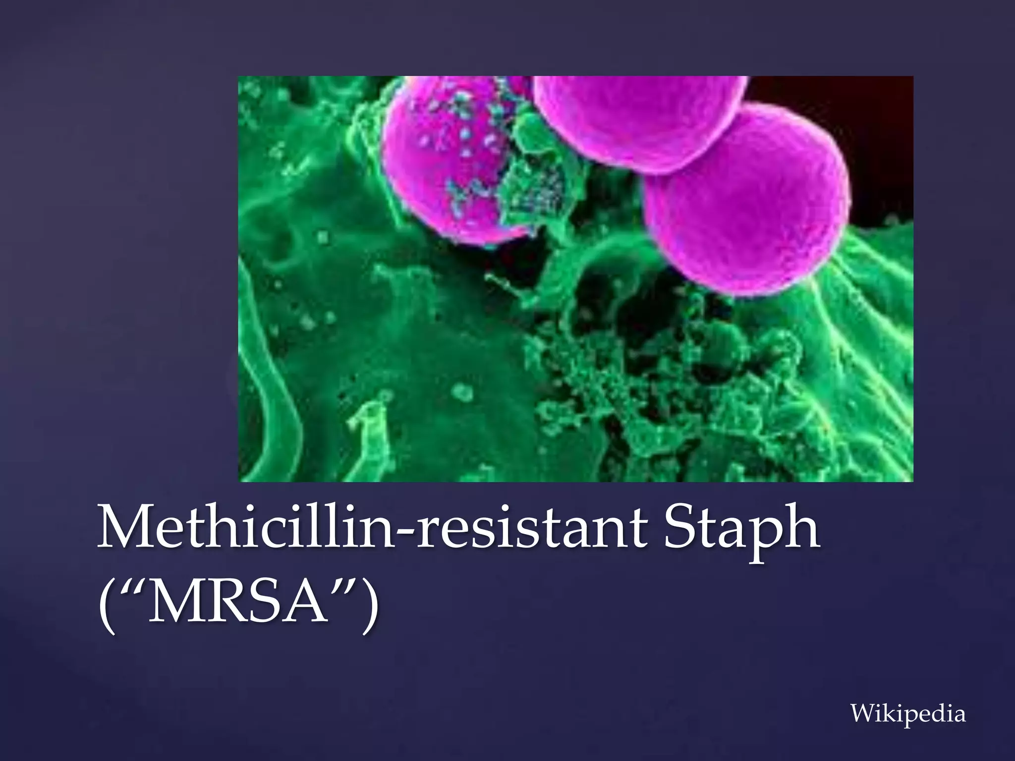 Methicillin-resistant Staph
(“MRSA”)
Wikipedia

 