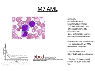 M7 AML
M7 AML
-acute leukemia of
Megakaryocyte lineage
~1-3% of adult AML cases
-often accompanied by
Fibrosis in BM
-poor px histologic subtype
-more common in children
-Some important associations:
1/3 patients with M7 AML
Have Down Syndrome
Another 1/3 have a
t(1;22)(p13;q13) translocation
The last 1/3 have a novel
Fusion not even published
Yet.

 