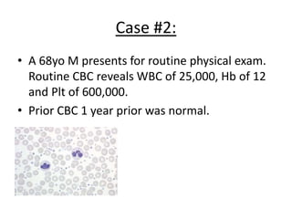 Case #2:
• A 68yo M presents for routine physical exam.
Routine CBC reveals WBC of 25,000, Hb of 12
and Plt of 600,000.
• Prior CBC 1 year prior was normal.

 