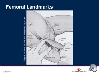 Roger’s Textbook of Pediatric Intensive Care, 4th ed.

Femoral Landmarks

Page 3

Pediatrics

xxx00.#####.ppt 2/26/2014 6:39:21 PM

 