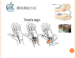 簡易測試方法
10
腕
 