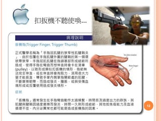 扣扳機不聽使喚...
12
 