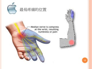 最易疼痛的位置
15
 