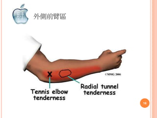 外側前臂區肘
16
 