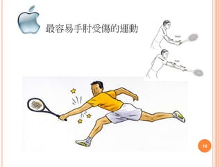 最容易手肘受傷的運動
18
 