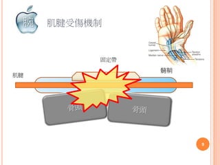 肌腱受傷機制
潤滑套髓鞘
固定帶
肌腱
9
腕
 