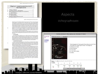 Castaigne, Juillet 2014, Journée PENSERA 5 
 