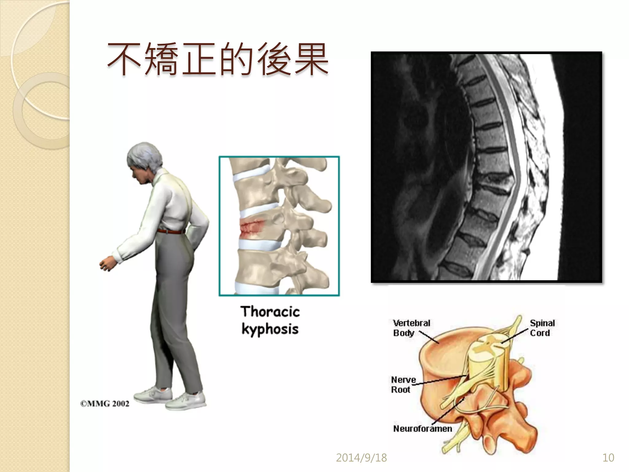 不矯正的後果 
2014/9/18 
10 
 