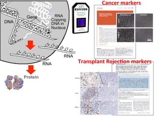 Protein
Cancer	
  markers	
  
Transplant	
  Rejec3on	
  markers	
  
 