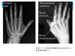 再看一下，因為我們要離開X光進入更可怕，
更複雜的領域了~
 