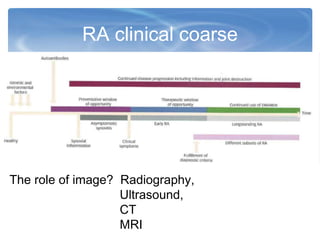 RA clinical coarse
The role of image? Radiography,
Ultrasound,
CT
MRI
 