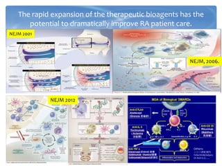 The rapid expansion of the therapeutic bioagents has the
potential to dramatically improve RA patient care.
NEJM 2001
NEJM, 2006.
NEJM 2012
Others:
小分子標靶藥物
Tofacitinib(Xeljanz
Or Anti-IL17…..
 