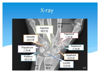 X-ray
 