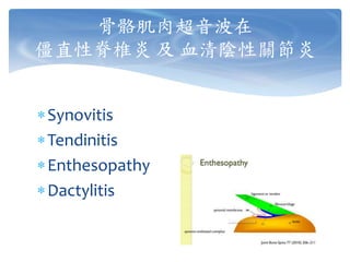 Synovitis
Tendinitis
Enthesopathy
Dactylitis
骨骼肌肉超音波在
僵直性脊椎炎 及 血清陰性關節炎
 