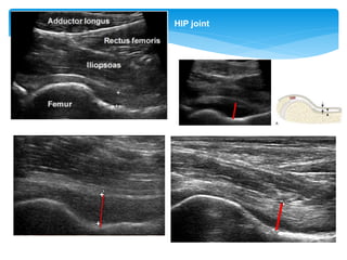 Taipei Medical University Hospital
HIP joint
 