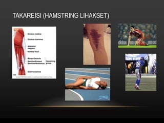 TAKAREISI (HAMSTRING LIHAKSET) 
 