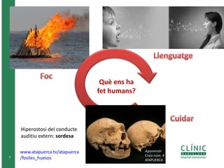 7 
Què ens ha 
fet humans? 
Agamenón 
Crani núm. 4 
ATAPUERCA 
Hiperostosi del conducte 
auditiu extern: sordesa 
www.atapuerca.tv/atapuerca 
/fosiles_huesos 
 