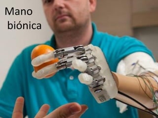 Mano 
biónica  