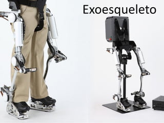 Exoesqueleto  