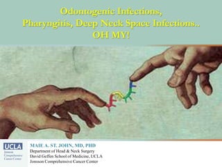 Odontogenic Infections,
Pharyngitis, Deep Neck Space Infections..
OH MY!
MAIE A. ST. JOHN, MD, PHD
Department of Head & Neck Surgery
David Geffen School of Medicine, UCLA
Jonsson Comprehensive Cancer Center
 