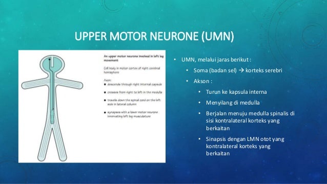 Mengenal Lokasi Gangguan Neurologis