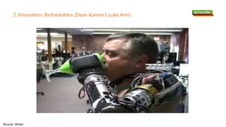 2. Innovation: Biohackables (Dean Kamen’s Luke Arm)
Source: Wired
 