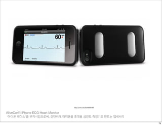 AliveCor의 iPhone ECG Heart Monitor
‘아이폰 케이스’를 부착시킴으로써, 간단하게 아이폰을 휴대용 심전도 측정기로 만드는 앱세서리
http://youtu.be/zIvzHkBiEaM
79
 