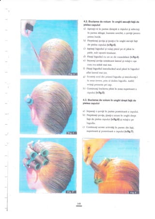 4.2. Buclarea de volum in unghi asculit

fali

de

pielea capului

&

a)

AqezaEi-va

in panea dreapu a capului

Ei selectagi

in partea stingA, inaintea urechii, o SuviF pentnr
prima buda.

b)

Pieptdnagi guvifa gi tineti-o ?n unghi ascugit fald

de pielea capului (v.fig.4).

c)

AEezagi bigudiul gi rulagi pdrul pe el

ptnd la

piele, sub usoara tensiune.

d) Fixa{i bigudiul
e) Separat-r Euvila

cu un ac de consolidare (v.fig.4}.
urmitoare lateral gi rula$-o

aga

cum s-a ari.tat mai sus.

0

Fixati bigudiul inroducind acul ptnd in bigudir.rl
aflat lateral mai jos.

g)

Scoatefi acul din primui bigudiu gi introducegiJ

in sens invers, prin al doilea bigudiu. Astfel
evita$ presarea pe cap.

h)

ConLinuagi buclarea pane

in zona superioani

a

capului (v.fi9.5).
4.3. Buclarea de volurn in unghi drept fald de

pielea capului

a) Separagi o Euvila in partea posrerioara a capului.
b) Pieptdnali guvrga, ginegi-o acum in unghi drept
fagd

de pielea capului (v.fi9.6) qi rulatri-o pe

bigudiu.

c) Continuagi

aceste activite$ in partera din tagi,

superioard qi posrerioari a capului (v.fig.Z).

*

Ki

€
#
.Ei.

-5
*

'ig

:

i
I

-t

l
I
I

l
I
I

*l
I
I
I
I
I
I

i

r

149

 