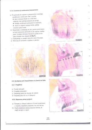 i

L-

Gontrolul 9i continuarea tratamontulul;

4.1 .4.

a)

.s

conuola$
in perioada de a4iune a preparanrlui
proba:
modifrcarea culorii prin cite o
a fost inci
x daca culoarea finala nu
mai aplicagi preparat pe quvrfi;

$',

oblinuti,
I subili$ urmetoarea perioadtr de aclionare;

a

:

dzc|s-a obginut nuanla doritA' spala$

temeinic

i

Pad ratat'

post tratare
Repaniza$ o substar4i Pe par, Pentru
de acgiune' spilagi
qi dupd epuizarea perioadei ei
pnd. $uviple devenite blonde le putegi acum
Faa cromatic mai departe (v'fi9'7);
c) fudeparta$ cu atenlie casca de unici folosinla;

b)

d)

€rq'
:E::

pnrului'
Efecnra$ inincheiere o spElare a

.?

't*. .,

E'i:

$

,.4
:l

r

i.;

b i E"ggtFl
{t:"%

ffinffi
4.2. $uvtfarea prin impachetare cu benzi de folie

42.1. Pregi$rea

a)

Punegi minuqile.

b) Pregatili preParatul.
c) Pieprnnali pdrul pe direc$a de cf,dere'
d) lmpantr Ped tn cca. 8 cdmPuri'

PF:,

4.2.2. Separarea Primei Portiuni:

cu cimpul mijlociu al zonei posterioare
a capului, separdnd po4iunea ca mat de jos;
DupI piepanare line$ po4iunea intinsi, in.

a) lniepep

b)

re

unghi ascuJit cu capul.

230

 