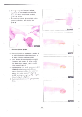 b) Scunra$ energic tticluta cu lac' Vedficati
@pacrtatq de lntindere a lacului de unghli'

I

I

t

I

I
I

Iacul prea vnscos rebuie diluat cu dteva
picinrri de diluant' '
c) Punegi sticlug cu lac in podul celeilalte palme,

I

-e*r***i*ae$i*:i.'.;::l

;

penmr a putea aplica lacul rapid gi sigur

(v.fis.2).
I
I

HFT

I

L-

T

g

w

I

I
I

I

ffi#e

t
i

Ern

I

4.d Tehnica aplicttil lacului

a)

I

Preluati pe pensula lac din sticlup Ei scurgeli de
pe ea lacul excedentar. Cantiatea necesard de
lac este in func1ie de merimea unghiei.

b)

Punegi pensula pe

m{locul suprafEei unghiei'

pielip, ytu:.dla
luni. Apo!, dintr-o rniqcare, trageli-o pine in
vifi unghiei (v.fi9.3'4)'
Deplasagi-o gXna aproape de

c)

Proceda$ identic gi pe pa$ile laterale ale unghiei
(v.fig.Sl. Aplica$ totdeauna lacul dinc-o
miscare, intr-un strat sub$re; el se va depune

.

uniforrn $i va rszi.sta mai mult. indepartagi
licuirile gle$itei pe intreaga suprafaga a unghiei,

d)

folosind solqia de lndePdrtare.
Dupa ce primul strat s-a uscat, aplicali sEatul al

*i

doilea.

i

I

l"

I

i
I
I

i

*--- E:!tr
.g

286

 
